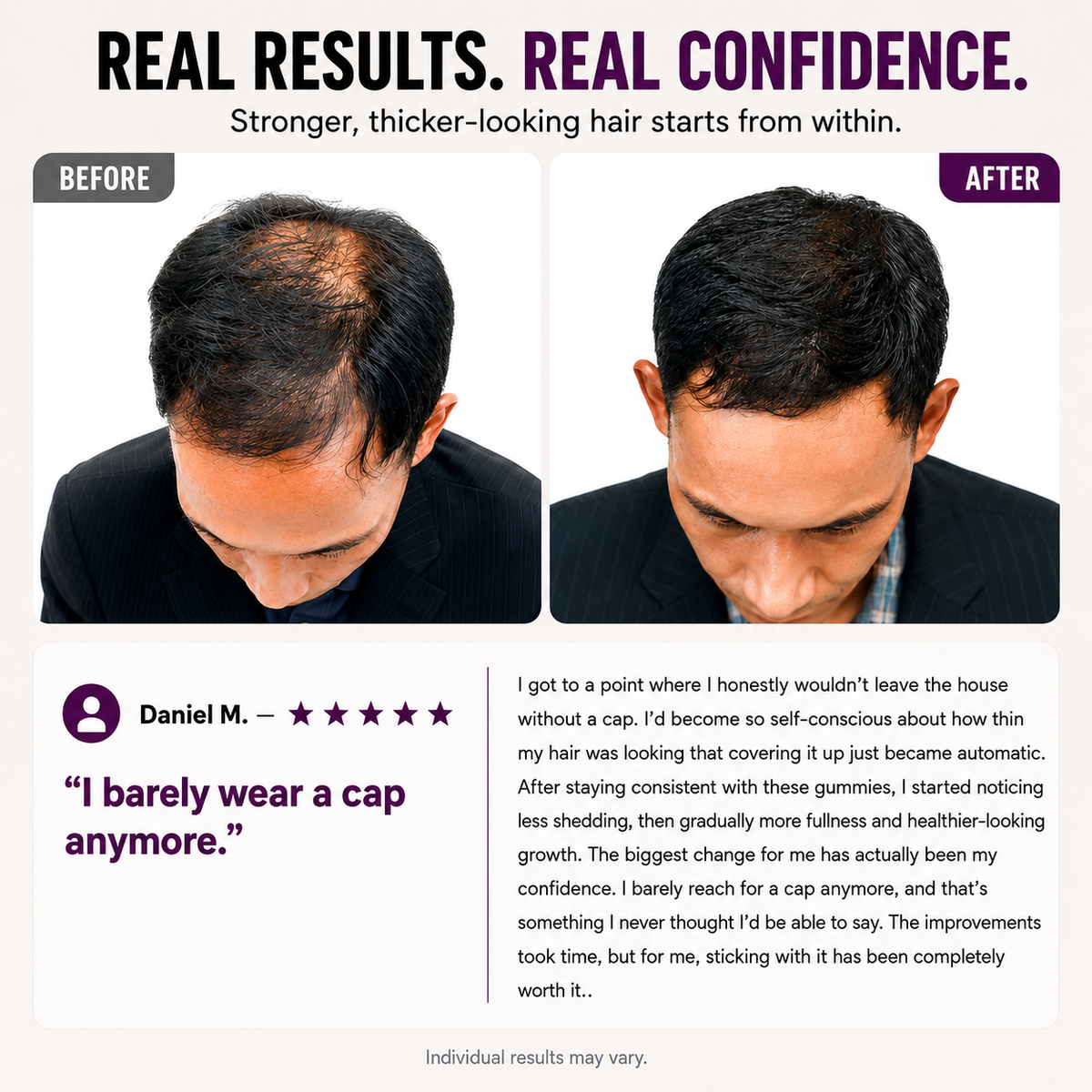 Hair Growth Gummies