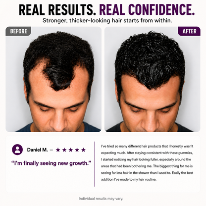 Hair Growth Gummies