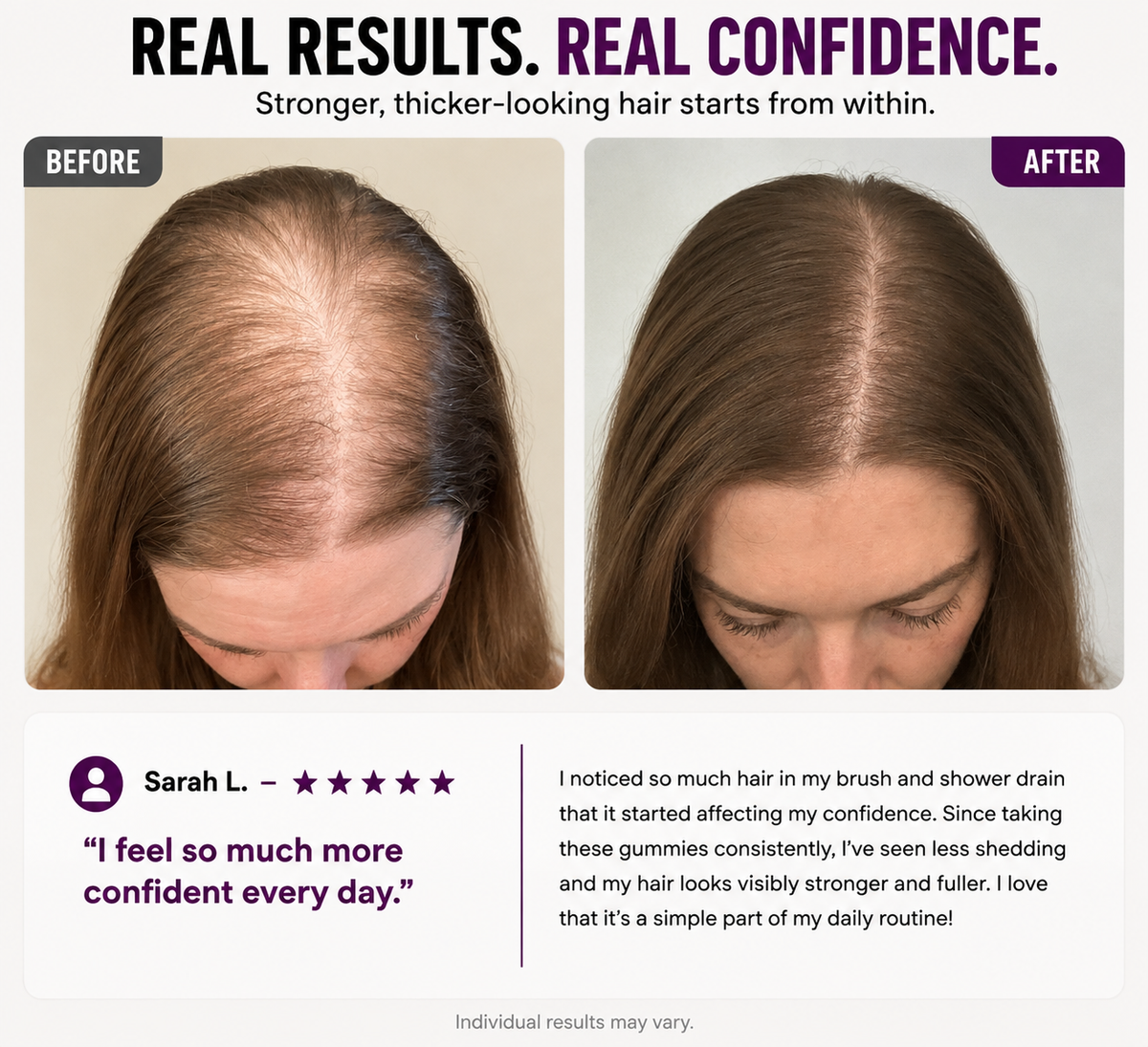 Hair Growth Gummies