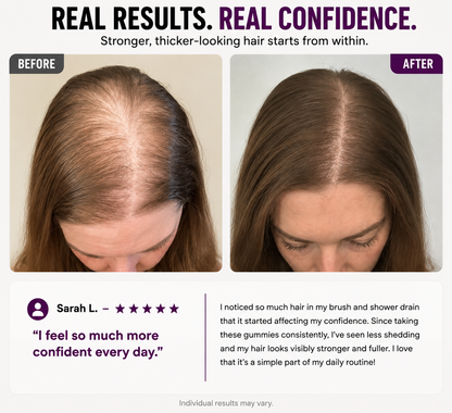 Hair Growth Gummies